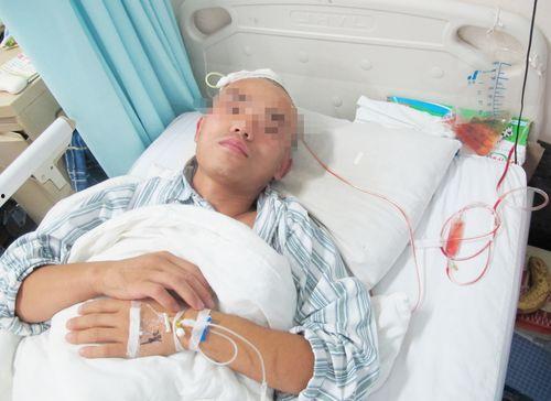 脑积水可以吃酥瓜吗视频